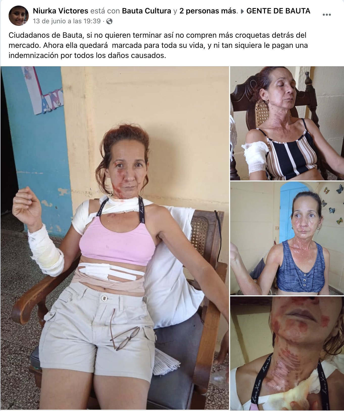 Cubanos denuncian venta de croquetas explosivas en Bauta 3