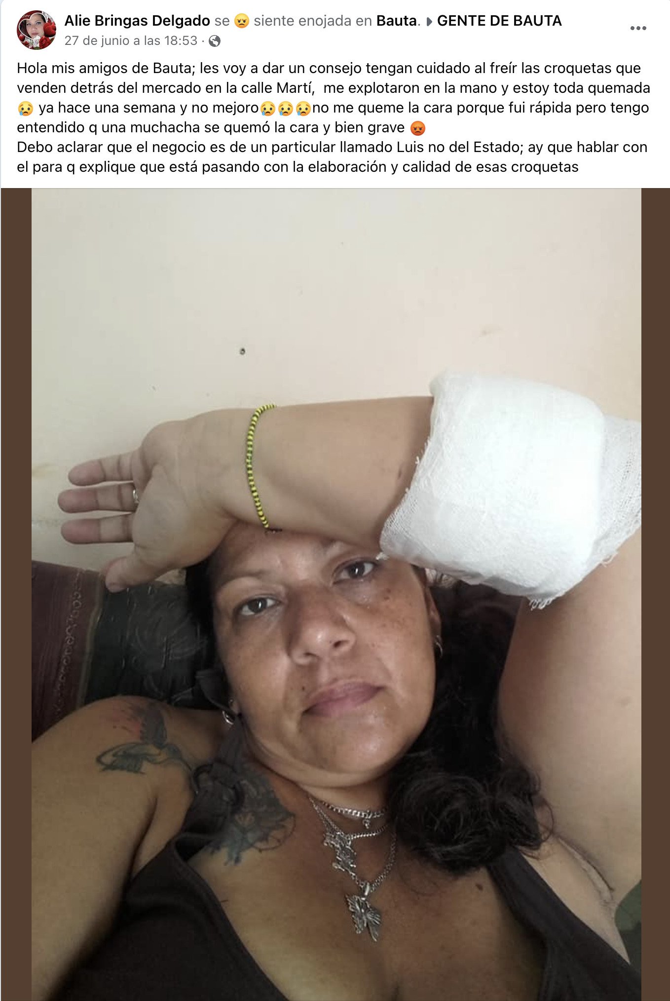 Cubanos denuncian venta de croquetas explosivas en Bauta 4