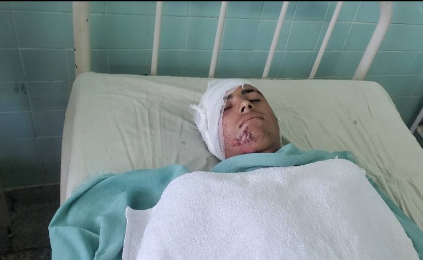 Adolescente cubano atropellado por un camión: "Estoy vivo de milagro" 4