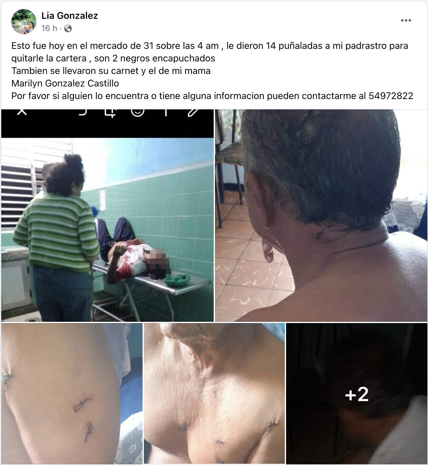 Apuñalan a hombre para robarle la billetera en La Habana 22