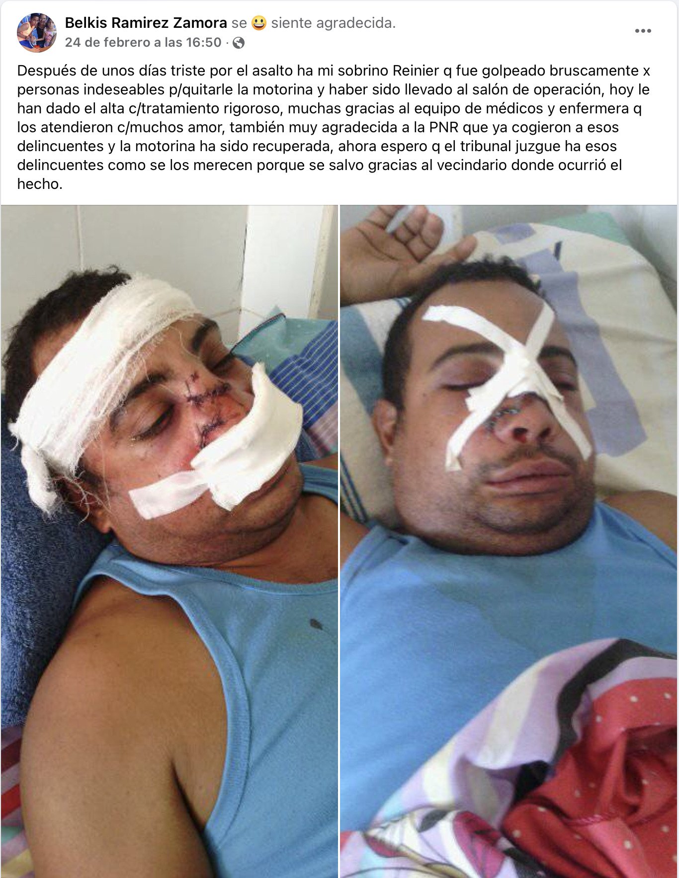 Golpean brutalmente a cubano para robarle su moto eléctrica en Santiago de Cuba 7