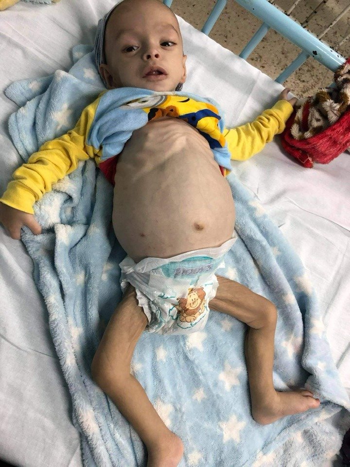 Padres desesperados piden ayuda para llevar a su hijo a EE.UU. para recibir tratamiento médico 6
